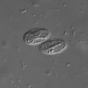 Giardia_cyst_dic2.jpg Figure B: Two <em>G. duodenalis</em> cysts in a wet mount under DIC microscopy; image taken at 1000× magnification.