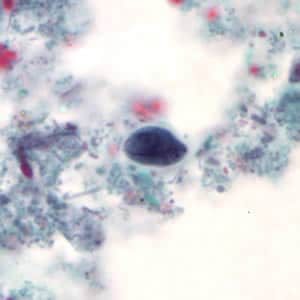 Giardia_cyst_tric.jpg Figure A: <em>G. duodenalis</em> cyst stained with trichrome.