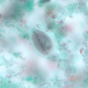 Giardia_cyst_tric10.jpg Figure J: <em>G. duodenalis</em> cyst stained with trichrome. Sometimes the cytoplasm of the cyst may retract from the cell wall.
