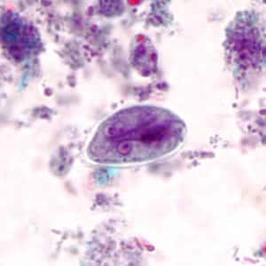 Giardia_cyst_tric2.jpg Figure B: <em>G. duodenalis</em> cyst stained with trichrome.