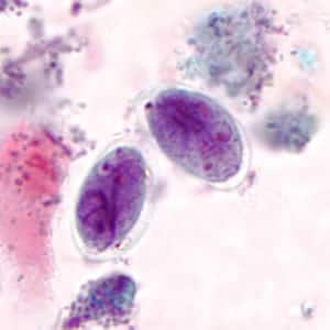 Giardia_cyst_tric3.jpg Figure C: <em>G. duodenalis</em> cysts stained with trichrome.