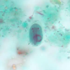 Giardia_cyst_tric4.jpg Figure D: <em>G. duodenalis</em> cyst stained with trichrome.