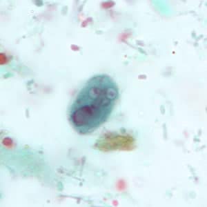 Giardia_cyst_tric5.jpg Figure E: <em>G. duodenalis</em> cyst stained with trichrome.