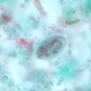 Giardia_cyst_tric6.jpg Figure F: <em>G. duodenalis</em> cyst stained with trichrome.