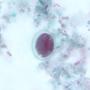 Giardia_cyst_tric7.jpg Figure G: <em>G. duodenalis</em> cyst stained with trichrome. Sometimes the cytoplasm of the cyst may retract from the cell wall.