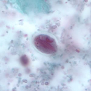 Giardia_cyst_tric8.jpg Figure H: <em>G. duodenalis</em> cyst stained with trichrome. Sometimes the cytoplasm of the cyst may retract from the cell wall.