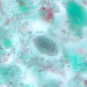 Giardia_cyst_tric9.jpg Figure I: <em>G. duodenalis</em> cyst stained with trichrome. Sometimes the cytoplasm of the cyst may retract from the cell wall.