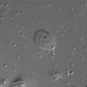Giardia_troph_dic.jpg Figure B: <em>G. duodenalis</em> trophozoite in a wet mount under differential interference contrast (DIC) microscopy. Image taken at 1000× magnification.