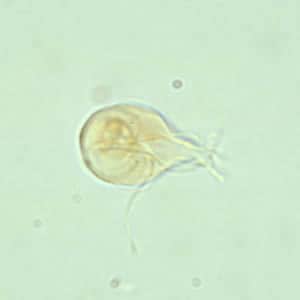 Giardia_troph_wtmt.jpg Figure A: <em>G. duodenalis</em> trophozoite in a wet mount stained with iodine.