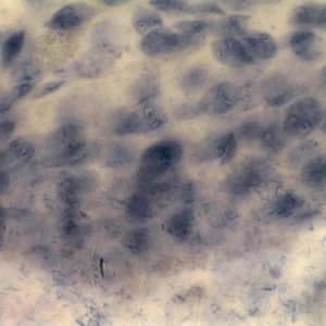 Giardia_troph_VT.jpg Figure D: <em>G. duodenalis</em> trophozoites. Image contributed by the Vermont Department of Health Laboratory.