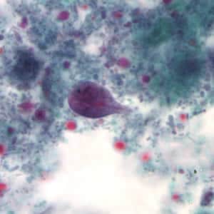 Giardia_troph_tric3.jpg Figure C: <em>Giardia duodenalis</em> trophozoite stained with trichrome.