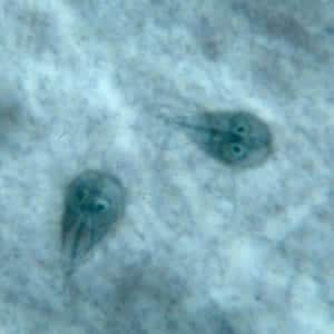 Giardia_troph_kohn.jpg Figure A: <em>G. duodenalis</em> trophozoites in Kohn stain.