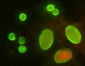 Giardia_cyst_IFA.jpg Figure A: Cysts of <em>G. duodenalis</em> (lower right) and oocysts of <em>Cryptosporidium parvum</em> (upper left) labeled with commercially available immunofluorescent antibodies.