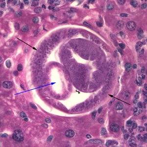 C_hepatica_500x_liver.jpg Figure B: Cross section of <em>C. hepatica</em> in liver tissue, stained with H&E. Note the presence of the intestine (blue arrow) and bacillary bands (black arrows).