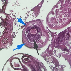 C_hepatica_adult_200x_HB.jpg Figure C: Cross-section of <em>C. hepatica</em> in liver tissue, stained with H&E. Note the presence of a stichocyte (black arrow) and bacillary bands (blue arrows). Image taken at 200x magnification.