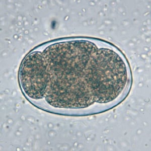 Hookworm_2x2_B.jpg Figure D: Hookworm egg in an unstained wet mount.