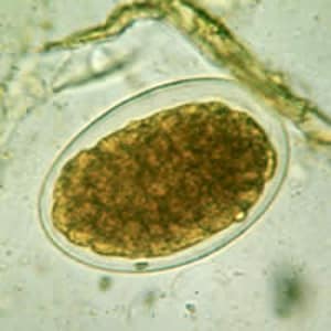 Hookworm_2x2_C.jpg Figure E: Hookworm egg in a wet mount.