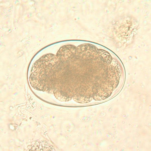 Hookworm_egg_BAM1.jpg Figure B: Hookworm egg in an unstained wet mount, taken at 400x magnification.