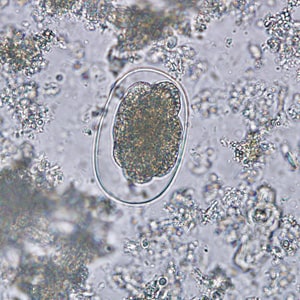 Hookworm_egg_BAM_MCS.jpg Figure C: Hookworm egg in an unstained wet mount.