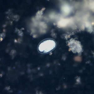 Hookworm_egg_uv_200x.jpg Figure F: Hookworm egg in a wet mount under UV fluorescence microscopy; image taken at 200x magnification.