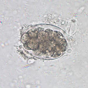 Hookworm_egg_wtmt.jpg Figure A: Hookworm egg in an unstained wet mount, taken at 400x magnification.