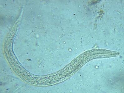 Hookworm_rhabditiform.jpg Figure A: Hookworm rhabditiform larva (wet preparation).