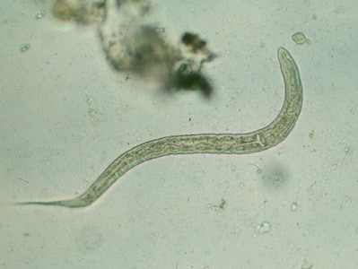 Hookworm_rhabditiform_2.jpg Figure B: Hookworm rhabditiform larva (wet preparation).