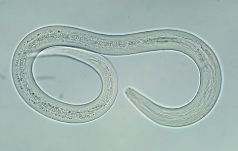 Hookworm_filariform_A.jpg Figure A