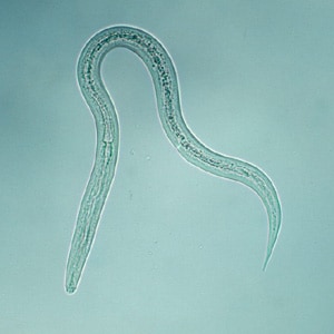 Hookworm_filariform_B.jpg Figure B