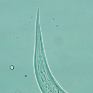 Hookworm_filariform_posterior_A.jpg Figure D