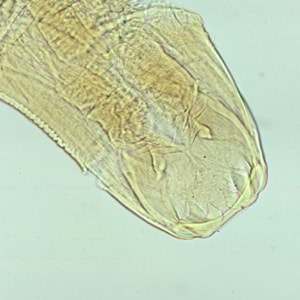 Aduodenale_head_A.jpg Figure A: Adult worm of <em>Ancylostoma duodenale</em>. Anterior end is depicted showing cutting teeth.