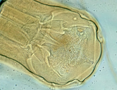 Namericanus_head_B.jpg Figure B: Adult worm of <em>Necator americanus</em>. Anterior end showing mouth parts with cutting plates.