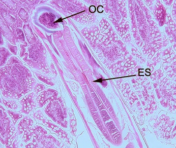 Hookworm_tissue_BAM1.jpg Figure A: Longitudinal section of an adult hookworm worm in a bowel biopsy, stained with H&E. Note the oral cavity (OC) and strong, muscled esophagus (ES).