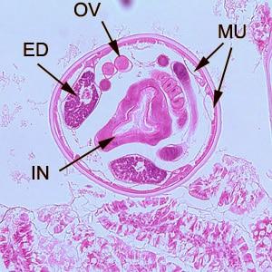 Hookworm_tissue_BAM2.jpg Figure B: Cross-section of an adult hookworm from the same specimen in Figure A. Shown here are the platymyarian musculature (MU), intestine with brush border (IN), excretory ducts (ED), and coiled ovaries (OV).