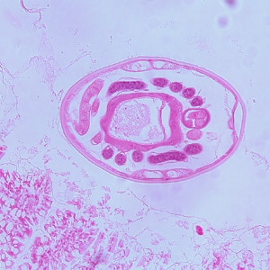 Hookworm_tissue_BAM3.jpg Figure C: Another-cross section of the specimen in Figures A and B.