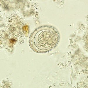 Figure C: Egg of <em>H. nana</em> in an unstained wet mount.