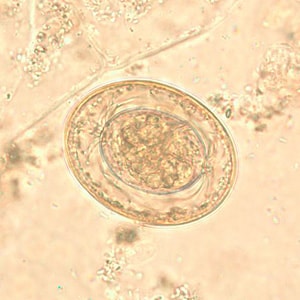 Figure E: Egg of <em>H. nana</em> in an unstained wet mount. In this image, the polar filaments in the space between the oncosphere and outer shell are clearly visible.