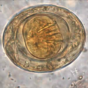 Figure D: Egg of <em>H. nana</em> in an unstained formalin ethyl acetate (FEA) wet mount. In this image, four of the hooks in the oncosphere are clearly visible. Image courtesy of the Oregon State Public Health Laboratory.