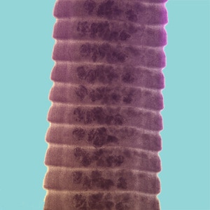 Figure D: Proglottids of <em>H. diminuta</em> stained with carmine. Notice the craspedote form of the proglottids.