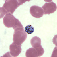 Case147_B.jpg Figure B