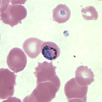 Case147_C.jpg Figure C