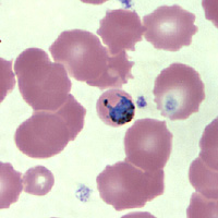 Case147_D.jpg Figure D