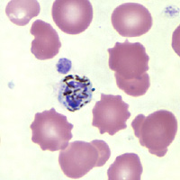 Case147_E.jpg Figure E