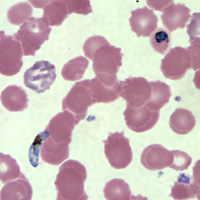 Case147_F.jpg Figure F