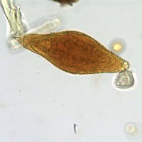 January - 2005 - Case #148 A public health laboratory sent images to DPDx for telediagnosis assistance to confirm their parasite identification of a 160 micrometer long object. The patient was a refugee from Africa.