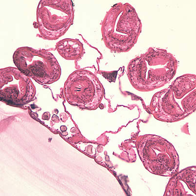 Case150_B.jpg Figure B