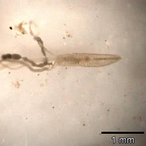March - 2005 - Case #151 A 39-year-old female had a descending colon biopsy to determine the cause of symptoms that included chronic abdominal pain and discomfort. No pertinent travel history was known.