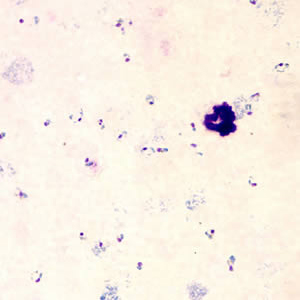 Case153_B.jpg Figure B