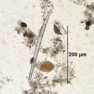 Case155_B.jpg Figure B
