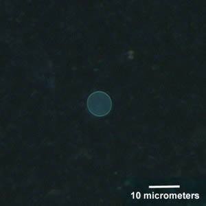 May - 2005 - Case #156 A 25-year-old man living in South America became ill with intestinal cramping and watery diarrhea. Stool specimens were collected and an O & P exam was ordered by his physician.